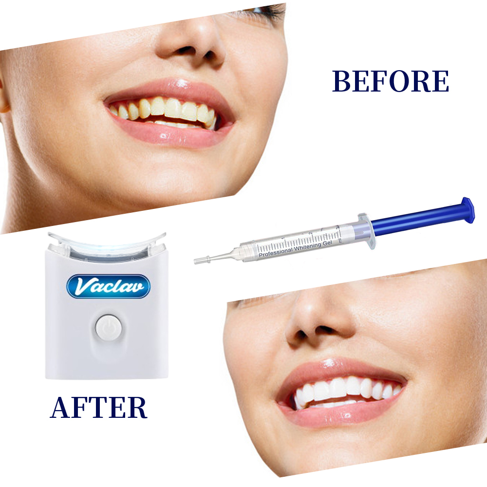 Mint Teeth Whitening Gel Syrin - огляд і ціна Teeth Whitening Kit At Home