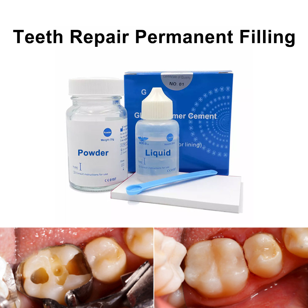 Permanent Teeth Filling Repair - огляд і ціна Teeth Whitening Kit At Home
