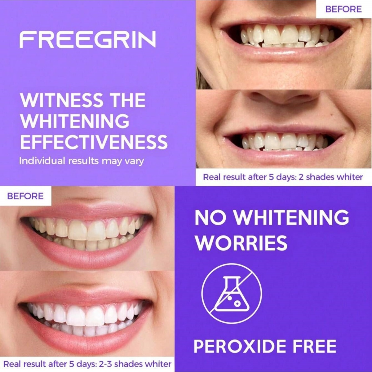 Deluxe Whitening Teeth Sticker - огляд і ціна Teeth Whitening Doctor